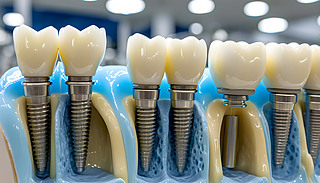 Ƽg(sh)MǸ͹ϵմNֲw