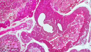 ǰٰ(x)Ԕ(x)W(xu)@΢Ƭչʾ˼(x)Y(ji)(gu)