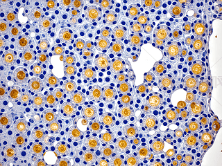 @΢Rµļ(x)Y(ji)(gu)