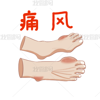 _P(gun)(ji)ʹL(fng)