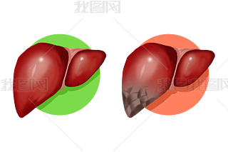 ֬θӲ