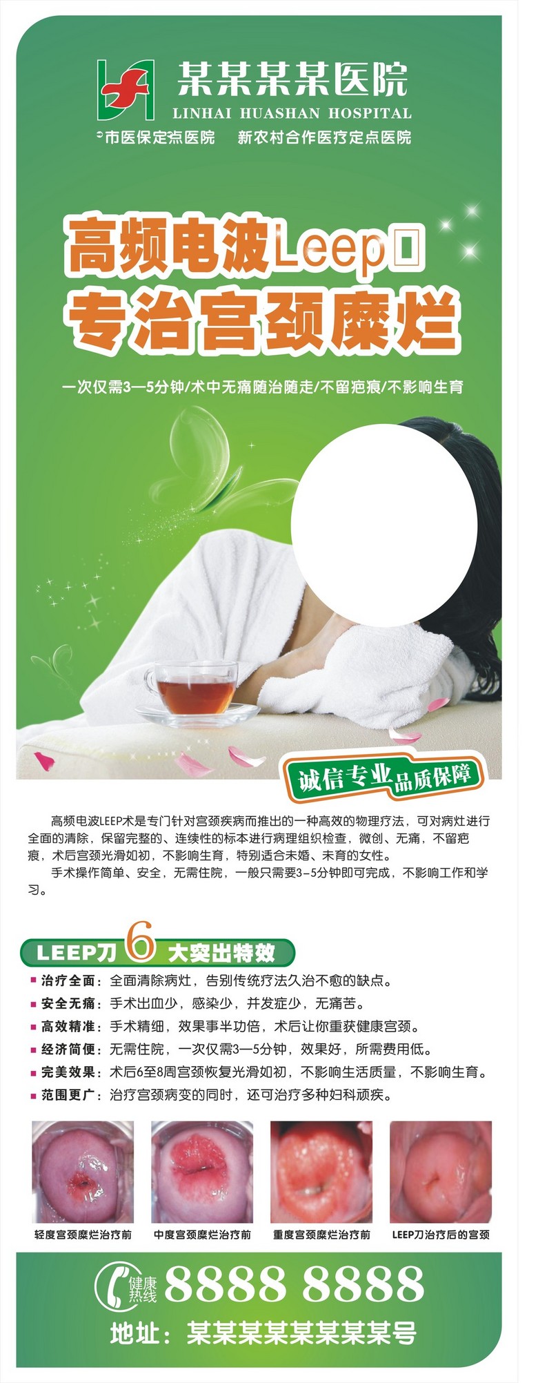 LEEP术利普刀治宫颈糜烂等疾病展架未转(图片