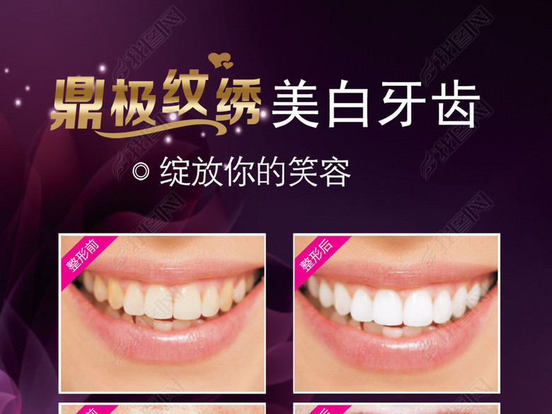 美容整形美白牙齿广告展板(图片编号:1704836