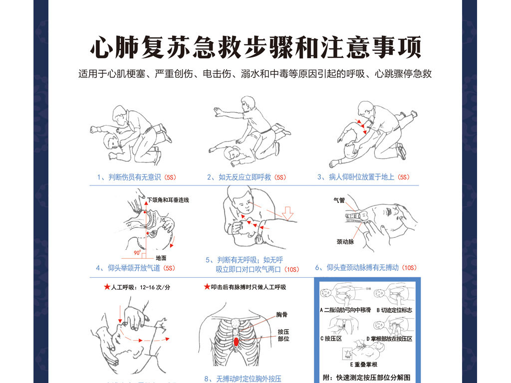 急救常识大全及资料 17141444-b3fb6c3b61b1ea2a6dabe20fef3f6c9a-4.jpg