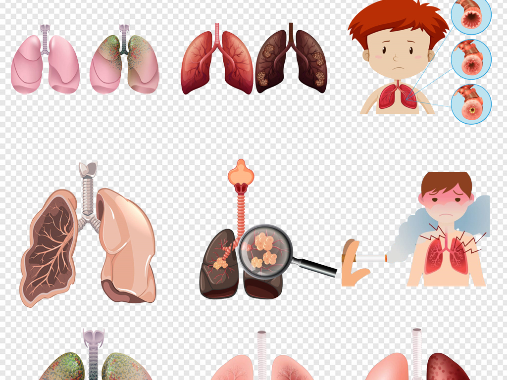 卡通手绘癌症肺癌肺部吸烟有害健康png