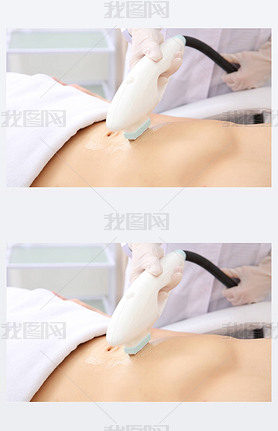 man getting laser epilation