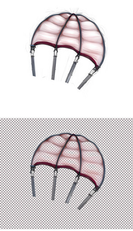 ͨwwս(2)