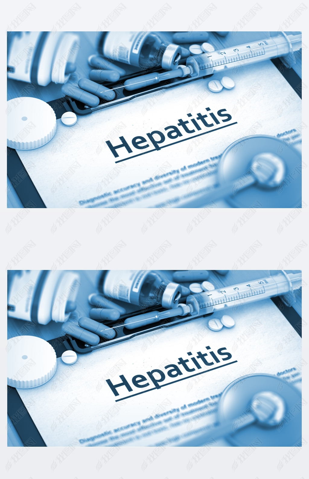 Hepatitis Diagnosis. Medical Concept.