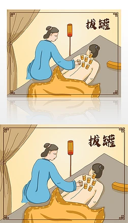 中国风传统拔罐手绘插画