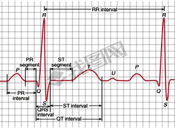  Qrs ϲĵͼͼ