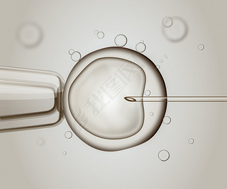  Ivf (ܾ)ܾϸ廭.