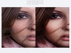 beautiful woman with before and after skin: problem skin with blemishes and clear complexion