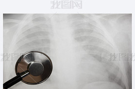 Medical stethoscope and x-ray or roentgen image. Close-up shot of lung radiography