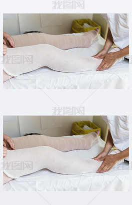 原创女人包扎病人的腿