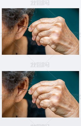 Senior woman putting earpick into her left ear, Grey curly hairs, Swimming pool background, Close up