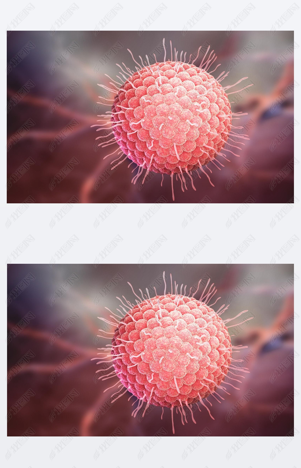 varicella zoster virus