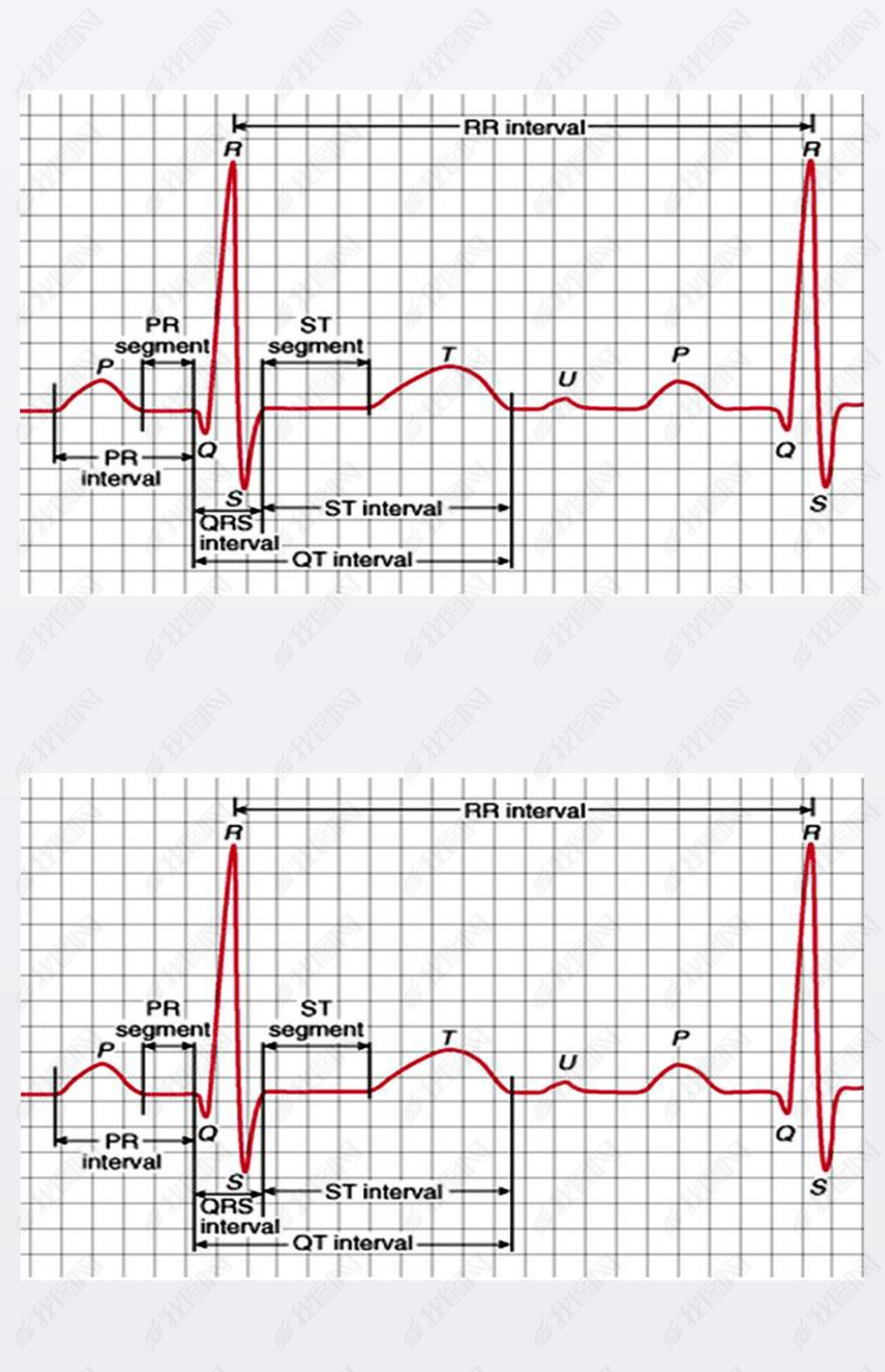  Qrs ϲĵͼͼ