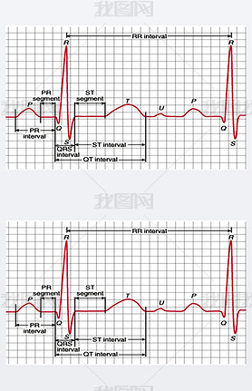  Qrs ϲĵͼͼ