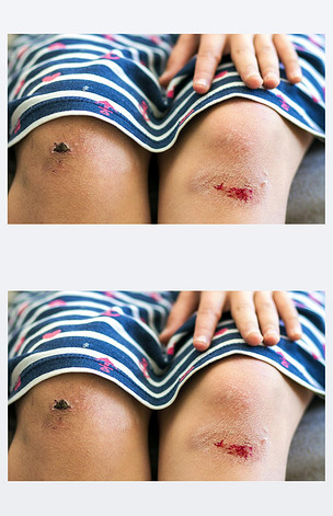 的小女孩抱着她伤痕累累的特写镜下载-编号25551701-人物情感-我图网