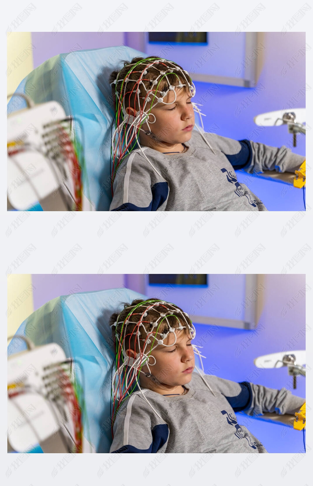 原创脑电图记录期间脑电图电极放置到病人身上脑电图脑电图版权可商用