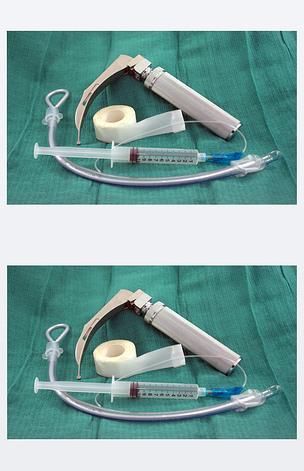 喉镜和气管插管
