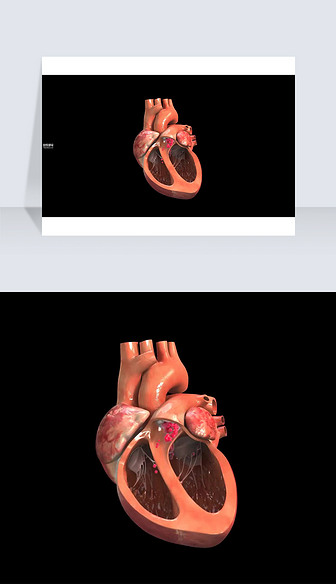 3D医疗视频截图心脏刨面