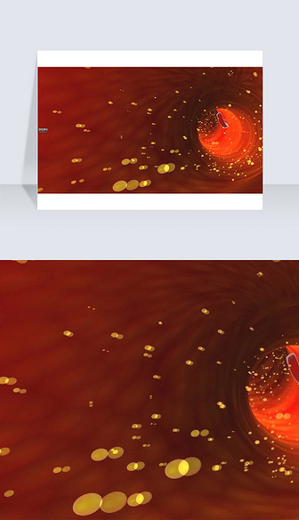 3D医疗视频血管内的疗效特效截图