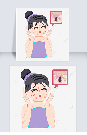 原创油性皮肤护肤痘痘插画