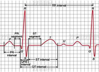  Qrs ϲĵͼͼ