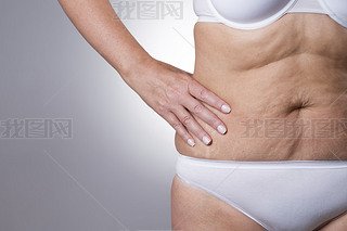 Flabby stomach of an elderly woman close-up