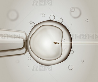  Ivf (ܾ)ܾϸ廭.