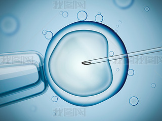 ʵҵ Ivf (ܾ) ΢о廭.