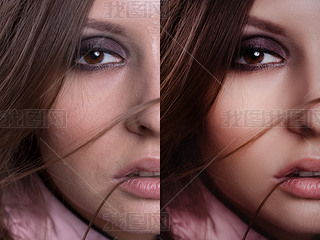 beautiful woman with before and after skin: problem skin with blemishes and clear complexion