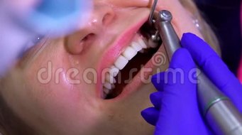 牙医正在对病人口腔进行专业的牙科清洁